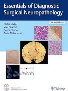 Essentials of Diagnostic Surgical Neuropathology