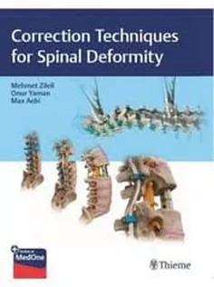 Correction Techniques for Spinal Deformity