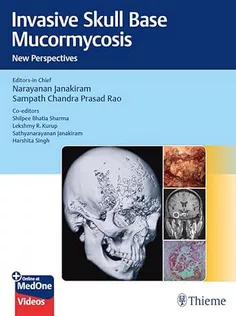 Invasive Skull Base Mucormycosis New Perspectives