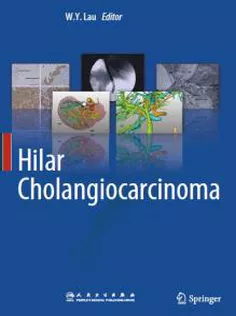 Hilar Cholangiocarcinoma