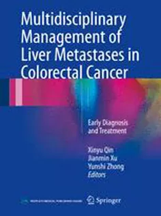 Multidisciplinary Management of Liver Metastases in Colorectal Cancer