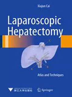 9789401798396 Laparoscopic Hepatectomy: Atlas and Techniques