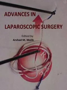 9789533079332 Advances In Laparoscopic Surgery