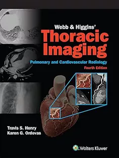 Webb & Higgins Thoracic Imaging