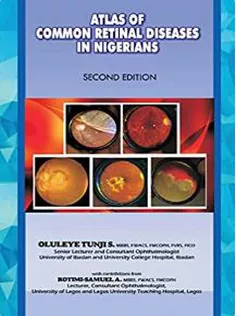 9789789212088 The Atlas of Retinal Diseases in Nigerians