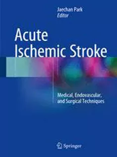 9789811009648 Acute Ischemic Stroke