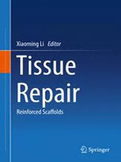 Tissue Repair: Reinforced Scaffolds