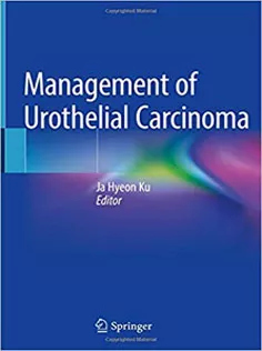 Management of Urothelial Carcinoma