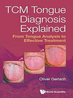 Tcm Tongue Diagnosis Explained: From Tongue Analysis To Effective Treatment