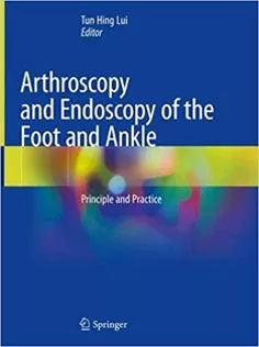 Arthroscopy and Endoscopy of the Foot and Ankle