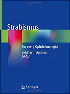 9789811311253 Strabismus: For Every Ophthalmologist