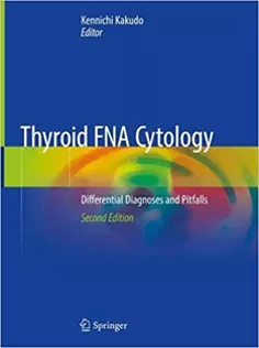 Thyroid FNA Cytology: Differential Diagnoses and Pitfalls