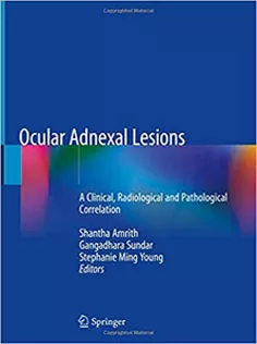 9789811337970 Ocular Adnexal Lesions