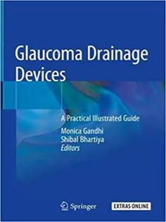 Glaucoma Drainage Devices: A Practical Illustrated Guide