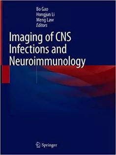 Imaging of CNS Infections and Neuroimmunology