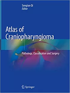 Atlas of Craniopharyngioma: Pathology, Classification and Surgery