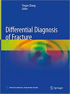 Differential Diagnosis of Fracture