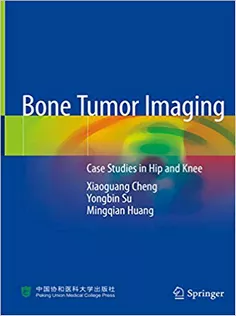 Bone Tumor Imaging: Case Studies in Hip and Knee