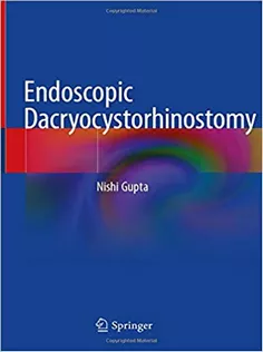 Endoscopic Dacryocystorhinostomy