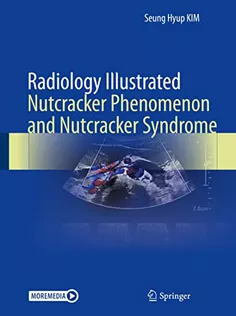 9789811662171 Radiology Illustrated: Nutcracker Phenomenon and Nutcracker Syndrome