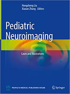 Pediatric Neuroimaging