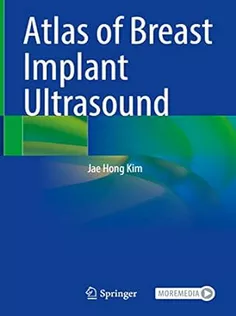 Atlas of Breast Implant Ultrasound