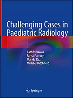 9789811959622 Challenging Cases in Paediatric Radiology