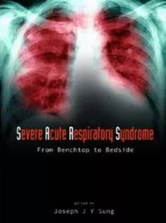 Severe Acute Respiratory Syndrome