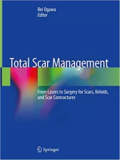 9789813297906 Total Scar Management: From Lasers to Surgery for Scars, Keloids, and Scar Contractures