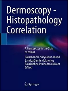 Dermoscopy - Histopathology Correlation