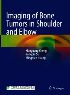 Imaging of Bone Tumors in Shoulder and Elbow