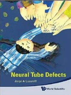 Neural Tube Defects