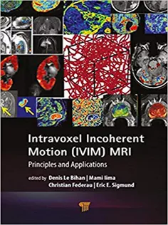 9789814800198 Intravoxel Incoherent Motion (IVIM) MRI