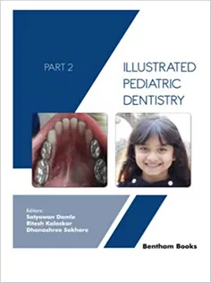 Illustrated Pediatric Dentistry - Part 2