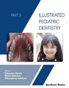 Illustrated Pediatric Dentistry - Part 3