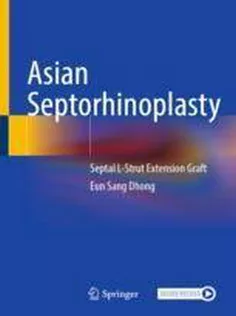 Asian Septorhinoplasty Septal L-Strut Extension Graft