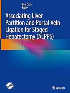 Associating Liver Partition and Portal Vein Ligation for Staged Hepatectomy