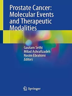 Prostate Cancer: Molecular Events and Therapeutic Modalities