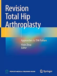 Revision Total Hip Arthroplasty: Approaches to THA Failure