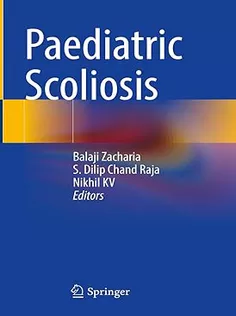 9789819930166 Paediatric Scoliosis