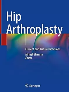 9789819955169 Hip Arthroplasty: Current and Future Directions