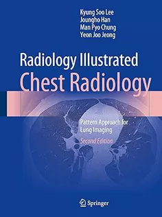 9789819966325 Radiology Illustrated: Chest Radiology