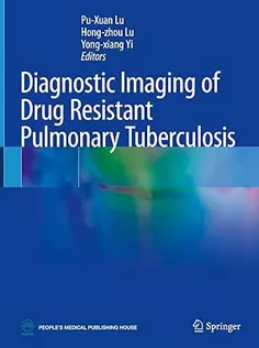 Diagnostic Imaging of Drug Resistant Pulmonary Tuberculosis