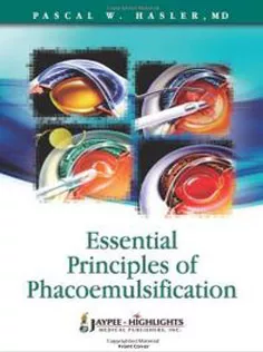 Essential Principles of Phacoemulsification