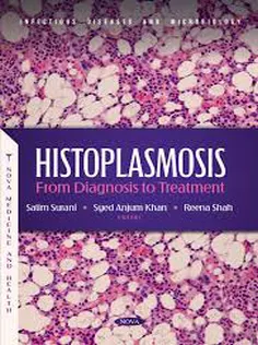 Histoplasmosis: From Diagnosis to TreatmentPublishing
