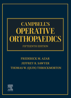 Campbell's-Operative-Orthopaedics-vol-4---85259