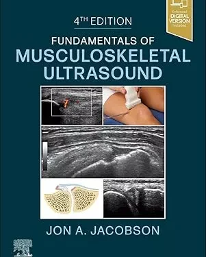 Fundamentals of Musculoskeletal Ultrasound (Fundamentals of Radiology)