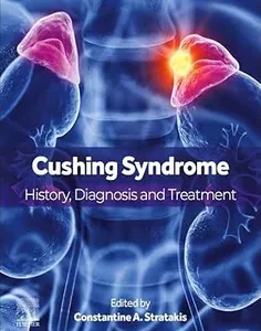 Cushing Syndrome: History, Diagnosis and Treatment
