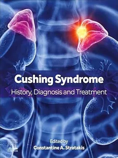 Cushing Syndrome: History, Diagnosis and Treatment