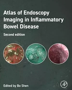 Atlas of Endoscopy Imaging in Inflammatory Bowel Disease